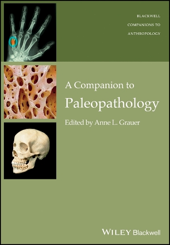 Companion to Paleopathology, A